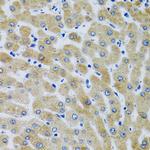 MBL2 Antibody in Immunohistochemistry (Paraffin) (IHC (P))