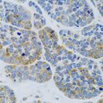 MBL2 Antibody in Immunohistochemistry (Paraffin) (IHC (P))
