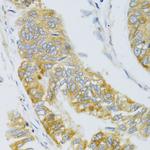 MBL2 Antibody in Immunohistochemistry (Paraffin) (IHC (P))
