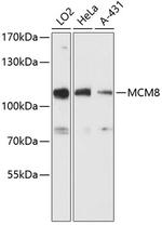 MCM8 Polyclonal Antibody