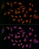 MDK Antibody in Immunocytochemistry (ICC/IF)