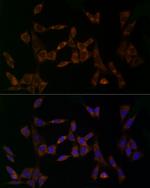 MDK Polyclonal Antibody