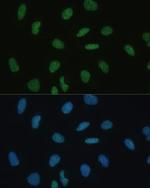 MKL1 Polyclonal Antibody