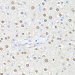 MLF2 Antibody in Immunohistochemistry (Paraffin) (IHC (P))