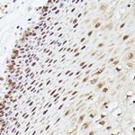 MLF2 Polyclonal Antibody
