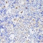MLF2 Antibody in Immunohistochemistry (Paraffin) (IHC (P))