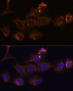 MMP25 Antibody in Immunocytochemistry (ICC/IF)