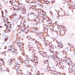 MRPL23 Antibody in Immunohistochemistry (Paraffin) (IHC (P))