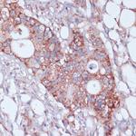 MRPL23 Antibody in Immunohistochemistry (Paraffin) (IHC (P))