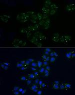 MRPL32 Polyclonal Antibody