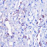 MRPL38 Polyclonal Antibody