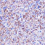 MRPL38 Antibody in Immunohistochemistry (Paraffin) (IHC (P))