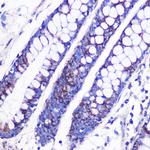 MRPL38 Antibody in Immunohistochemistry (Paraffin) (IHC (P))