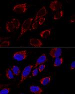 MRPS31 Polyclonal Antibody