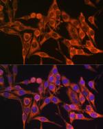 MT-ATP8 Antibody in Immunocytochemistry (ICC/IF)