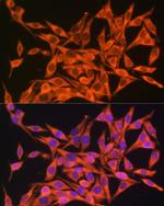 MT-ATP8 Polyclonal Antibody