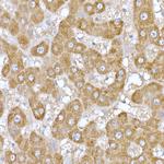 MT-ND6 Antibody in Immunohistochemistry (Paraffin) (IHC (P))