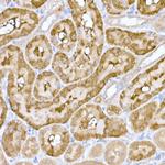 MT-ND6 Antibody in Immunohistochemistry (Paraffin) (IHC (P))