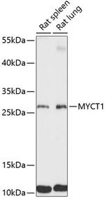 MYCT1 Antibody in Western Blot (WB)