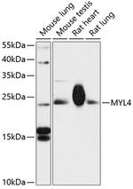 MYL4 Polyclonal Antibody