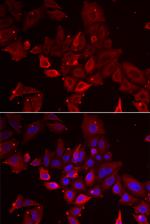 Myotilin Antibody in Immunocytochemistry (ICC/IF)