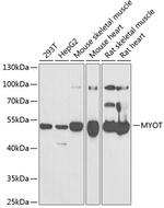Myotilin Antibody in Western Blot (WB)