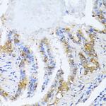 NAT2 Antibody in Immunohistochemistry (Paraffin) (IHC (P))
