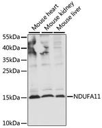 NDUFA11 Polyclonal Antibody