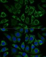 NDUFS8 Polyclonal Antibody