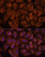 NEXN Polyclonal Antibody