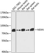 NEXN Antibody in Western Blot (WB)