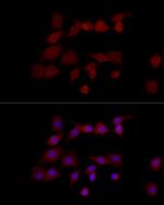 NGLY1 Polyclonal Antibody