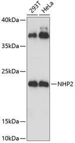 NHP2 Polyclonal Antibody