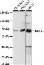 NOC4L Polyclonal Antibody