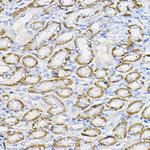 NUBP1 Polyclonal Antibody