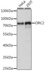 ORC2 Polyclonal Antibody