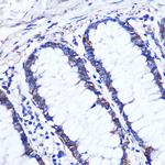 OTUD7B Antibody in Immunohistochemistry (Paraffin) (IHC (P))