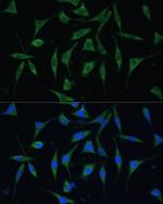 PALD1 Polyclonal Antibody