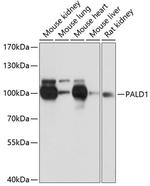 PALD1 Antibody in Western Blot (WB)