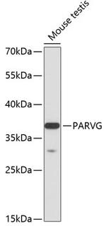 PARVG Antibody in Western Blot (WB)