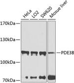 PDE3B Polyclonal Antibody