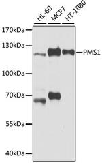 PDGFRB Polyclonal Antibody