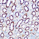PDHA1 Antibody in Immunohistochemistry (Paraffin) (IHC (P))
