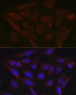 PDK4 Polyclonal Antibody