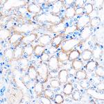 PDXP Antibody in Immunohistochemistry (Paraffin) (IHC (P))