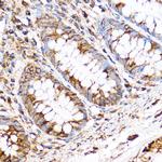 PDXP Antibody in Immunohistochemistry (Paraffin) (IHC (P))