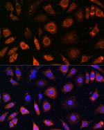 PFDN4 Antibody in Immunocytochemistry (ICC/IF)