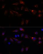 PFDN4 Polyclonal Antibody