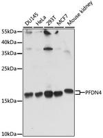 PFDN4 Antibody in Western Blot (WB)