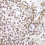 PHIP Antibody in Immunohistochemistry (Paraffin) (IHC (P))